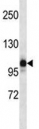 NLRP12 antibody western blot analysis in human placenta tissue lysate. Predicted molecular weight: ~119kDa, routinely observed at 100~119kDa.