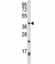 PITX2 antibody western blot analysis in CEM lysate. Predicted molecular weight ~35 kDa.