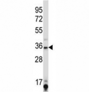 SIRT6 antibody western blot analysis in K562 lysate.