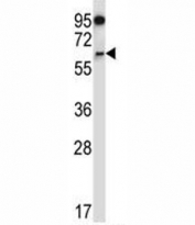 NOX4 antibody western blot analysis in CEM lysate. Expected molecular weight: ~65 kDa, 75-80 kDa.
