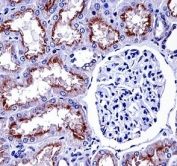 NOX4 antibody IHC analysis in formalin fixed and paraffin embedded human kidney tissue.