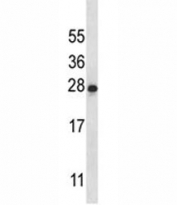 IL-22 antibody western blot analysis in K562 lysate. Observed molecular weight: 19~25kDa depending on glycosylation level.