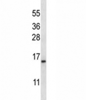 BAFF antibody western blot analysis in K562 lysate. Expected molecular weight ~19kDa.