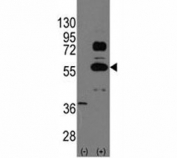 Western blot analysis of SOX9 antibody and 293 cell lysate (2 ug/lane) either nontransfected (Lane 1) or transiently transfected with the SOX9 gene (2). Predicted molecular weight: 56-65 kDa.