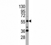 Western blot analysis of SOX9 antibody and K562 lysate. Predicted molecular weight: 56-65 kDa.