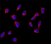 Immunofluorescence analysis of SOX9 antibody and HeLa cells. Primary antibody was followed by Alexa-Fluor-546-conjugated donkey anti-rabbit lgG (H+L). Alexa-Fluor-546 emits orange fluorescence. Blue counterstaining is DAPI.