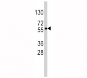 Western blot analysis of SOX-9 antibody and HepG2 lysate. Predicted molecular weight: 56-65 kDa.