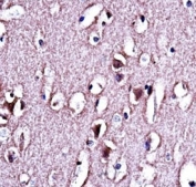 LMO2 antibody immunohistochemistry analysis in formalin fixed and paraffin embedded human brain tissue.