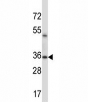 ERCC1 antibody western blot analysis in mouse lung tissue lysate