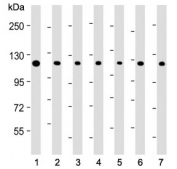 Western blot testing of human 1) HeLa, 2) HT-29, 3) Jurkat, 4) MOLT4, 5) PC-3, 6) 293 and 7) COLO205 cell lysate with TERT antibody. Predicted molecular weight: 89-126 kDa (four isoforms may be visualized).