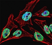 Fluorescent confocal image of HeLa cell stained with TERT antibody at 1:25. Immunoreactivity is localized to the nucleus strongly and cytoplasm weakly.