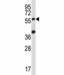 SOCS6 antibody western blot analysis in 293 lysate.