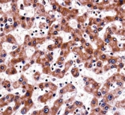 TRAP-1 antibody immunohistochemistry analysis in formalin fixed and paraffin embedded human liver tissue.
