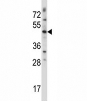 WNT3 antibody western blot analysis in CEM lysate. Predicted molecular weight 39~65 kDa depending on glycosylation level.