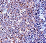 CD43 antibody immunohistochemistry analysis in formalin fixed and paraffin embedded human tonsil tissue.