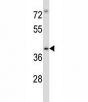 Irak4 antibody western blot analysis in MDA-MB435 lysate. Predicted molecular weight 52/37 kDa (isoforms 1/2).