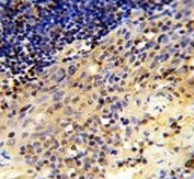 IHC analysis of FFPE human tonsil tissue stained with CD8A antibody