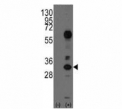 Western blot analysis of CD8A antibody and 293 cell lysate (2 ug/lane) either nontransfected (Lane 1) or transiently transfected with the CD8A gene (2).