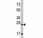 Western blot analysis of CD8A antibody and HeLa lysate.