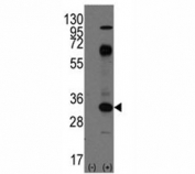 Western blot analysis of CD8 antibody and 293 cell lysate (2 ug/lane) either nontransfected (Lane 1) or transiently transfected with the CD8A gene (2).