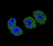 Confocal immunofluorescent analysis of FOXO3 antibody with MCF-7 cells followed by Alexa Fluor 488-conjugated goat anti-rabbit lgG (green). DAPI was used as a nuclear counterstain (blue).
