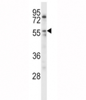 LPL antibody western blot analysis in HL-60 lysate.