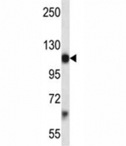 Pdgfra antibody western blot analysis in mouse brain tissue lysate. Predicted molecular weight: 120-195 kDa.