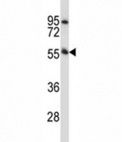 Pink1 antibody western blot analysis in mouse heart tissue lysate. Predicted molecular weight: 60-70 kDa.