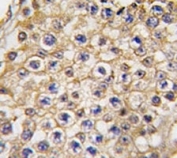 IHC analysis of FFPE human testis tissue stained with TRPV3 antibody