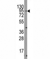 Western blot analysis of TRPV3 antibody and mouse heart tissue lysate