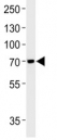Anti-TAU antibody western blot analysis in SH-SY5Y lysate. Expected molecular weight: 50-80 kDa.