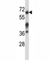 Irak3 antibody western blot analysis in mouse kidney tissue lysate. Predicted molecular weight: ~68kDa.