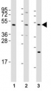 Western blot testing of Mlkl antibody at 1:2000 dilution and mouse samples: (1) testis, (2) liver, (3) NIH3T3 lysate; Predicted size: 54 kDa.