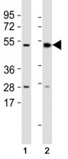 Western blot testing of Mlkl antibody at 1:1000 dilution and mouse samples: (1) lung, (2) spleen lysate; Predicted size: 54 kDa.