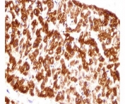 DES / Desmin antibody immunohistochemistry analysis in formalin fixed and paraffin embedded human heart tissue.