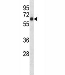 S6k1 antibody western blot analysis in mouse heart tissue lysate. Predicted molecular weight: 60-70 kDa~