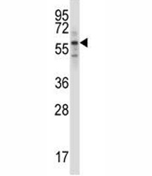 S6k1 antibody western blot analysis in ZR-75-1 lysate.