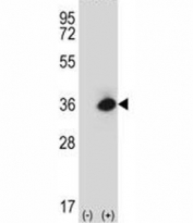 Western blot analysis of Rage antibody and 293 cell lysate (2 ug/lane) either nontransfected (Lane 1) or transiently transfected (2) with the mouse Rage gene.