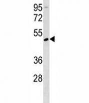Rage antibody western blot analysis in mouse Neuro-2a lysate. Predicted molecular weight: 45-55kDa depending on glycosylation level.