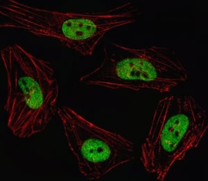 Fluorescent image of HeLa cell stained with PITX2 antibody. Alexa Fluor 488 conjugated secondary (green) was used. Cytoplasmic actin was counterstained with Alexa Fluor 555 (red) conjugated Phalloidin. PITX2 immunoreactivity is localized to the nucleus.~