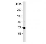 Western blot testing of human HepG2 cell lysate with AFP antibody. Predicted molecular weight ~69 kDa.