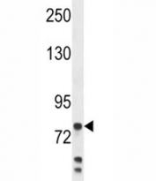 Anti-Myeloperoxidase antibody western blot analysis in MDA-MB231 lysate. Expected molecular weight: 59-64 kDa (alpha chain, may be observed at higher molecular weights due to glycosylation), 150+ kDa (glycosylated mature form).