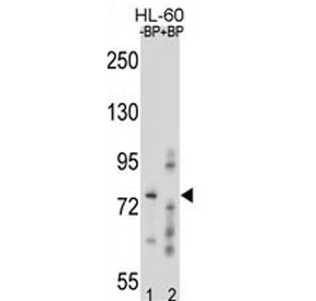 Western blot analysis of RNF40 antibody pre-incubated without (Lane 1) and with (2) blocking peptide in HL-60 lysate.