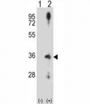 Western blot analysis of Cyclin D2 antibody and 293 cell lysate (2 ug/lane) either nontransfected (Lane 1) or transiently transfected (2) with the CCND2 gene. Predicted molecular weight ~33 kDa.