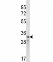 Cyclin D2 antibody western blot analysis in CEM lysate. Predicted molecular weight ~33 kDa.