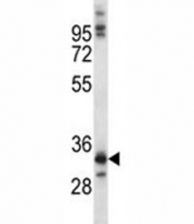 NKX6.1 antibody western blot analysis in A549 lysate.