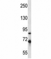 Irak1 antibody western blot analysis in mouse Neuro-2a lysate. Predicted molecular weight ~76 kDa.