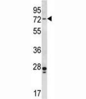 Pak4 antibody western blot analysis in human MCF-7 lysate.