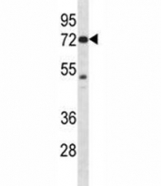 Pak4 antibody western blot analysis in mouse Neuro-2a lysate