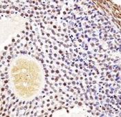 Wee2 antibody immunohistochemistry analysis in formalin fixed and paraffin embedded mouse ovarian tissue.